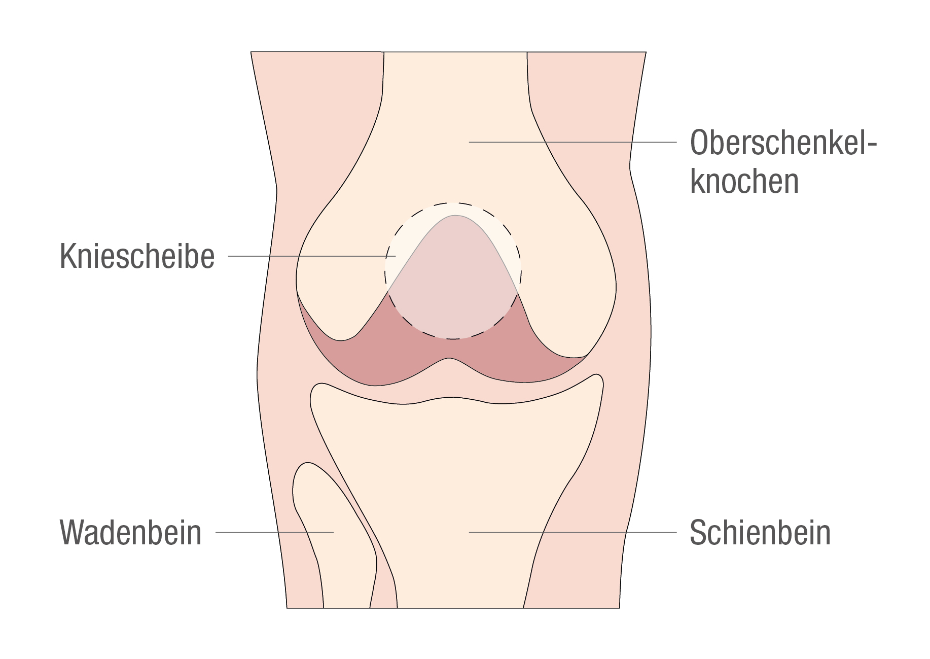 Grafische Darstellung des Knies. in diesem Bereich kommt es häufiger zu einer Patellaluxation