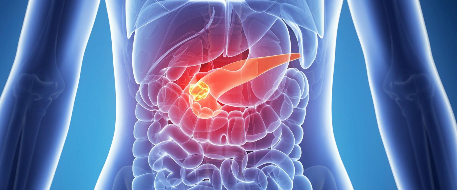 Wie Lange Lebt Man Mit Bauchspeicheldrüsenkrebs www.gesundheitsliebe.de